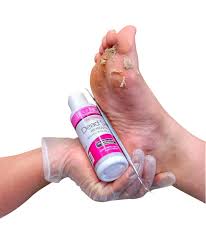 Removedor Piel Muerta 2oz